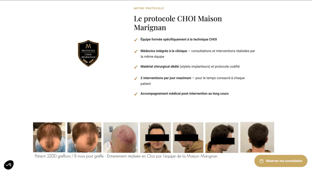 greffe de cheveux paris Maison Marignan