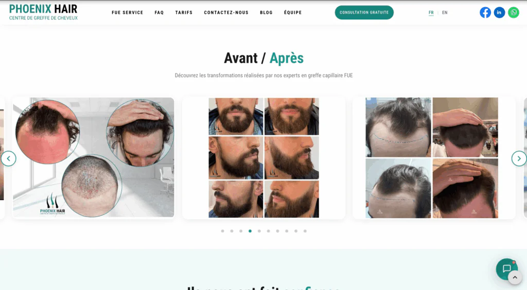 greffe de cheveux paris Phoenix Hair Center