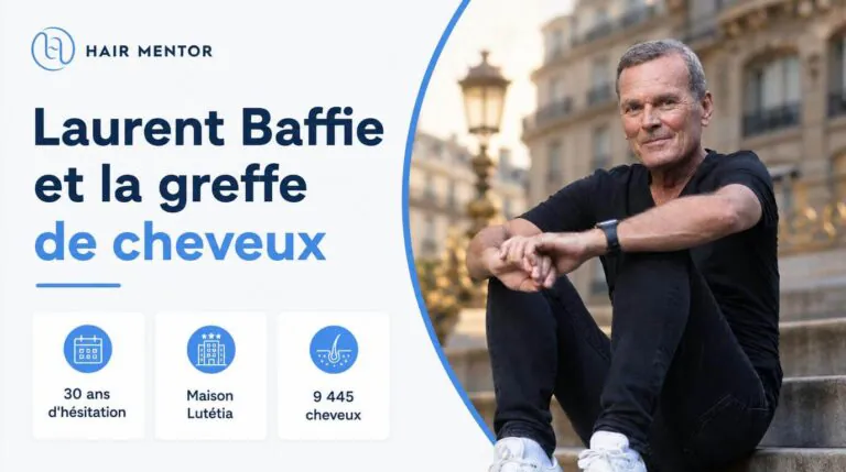 Laurent Baffie Greffe de Cheveux : 30 ans d’hésitation, 9 445 cheveux et un récit sans filtre