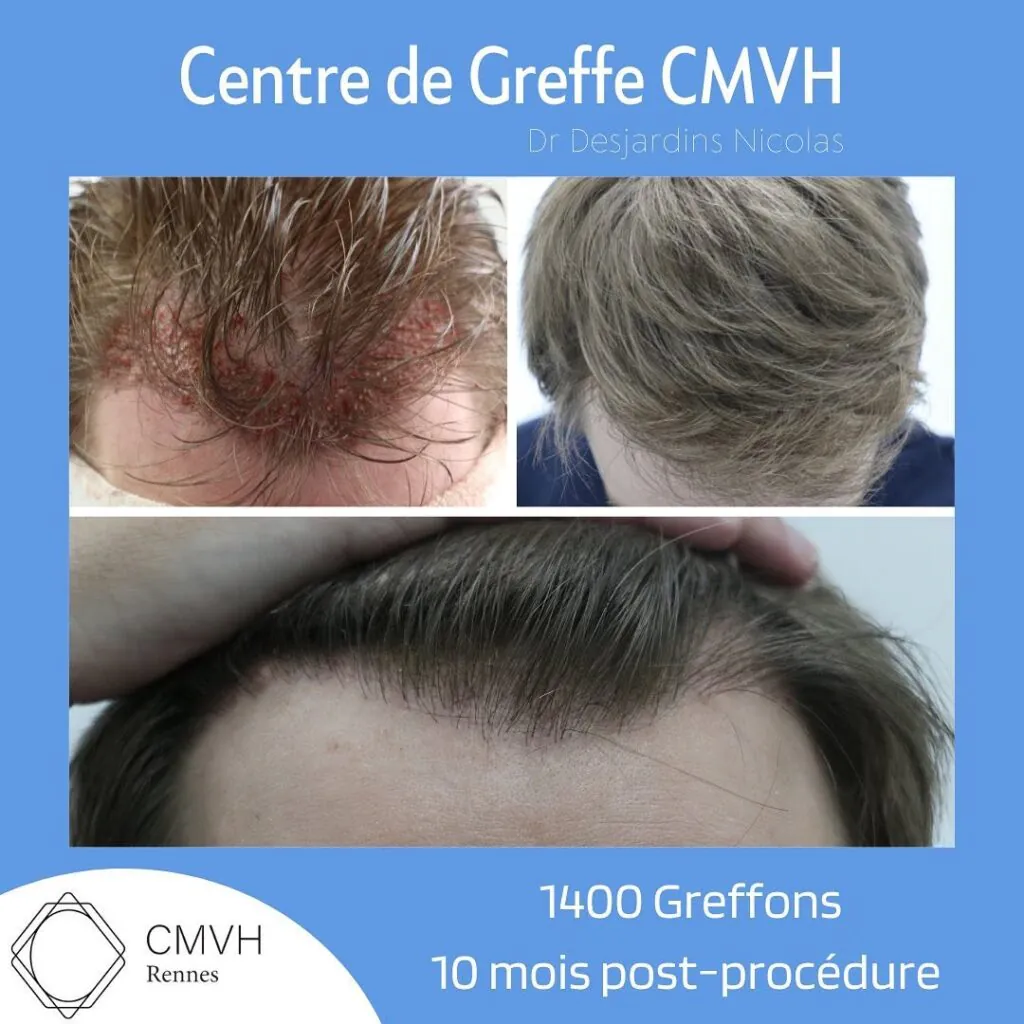 Avis CMVH 