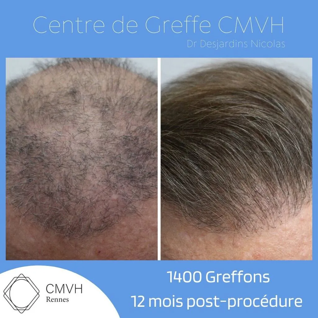 Avis photo CMVH (Rennes)