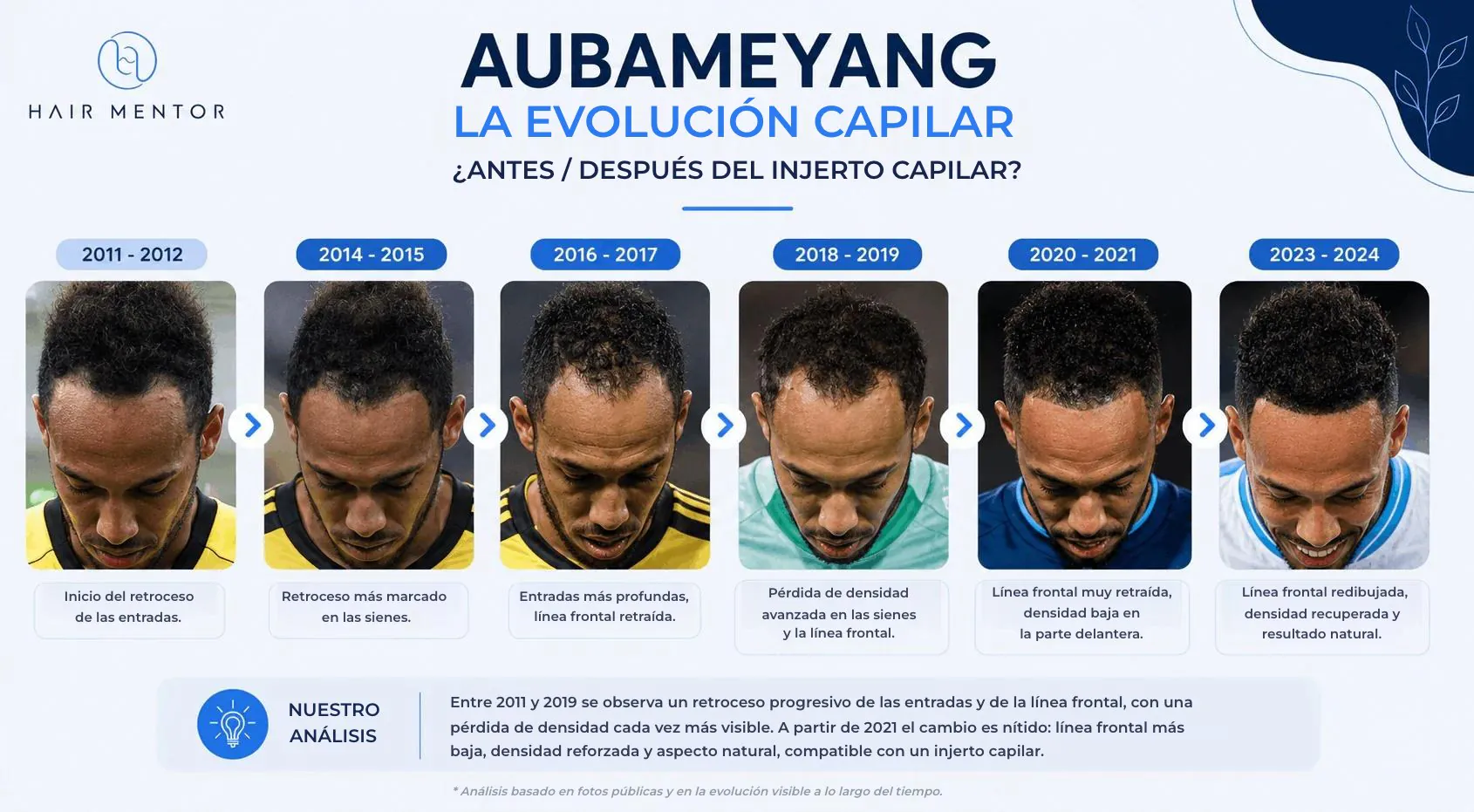 Cronología de la evolución capilar de Aubameyang entre 2011 y 2024