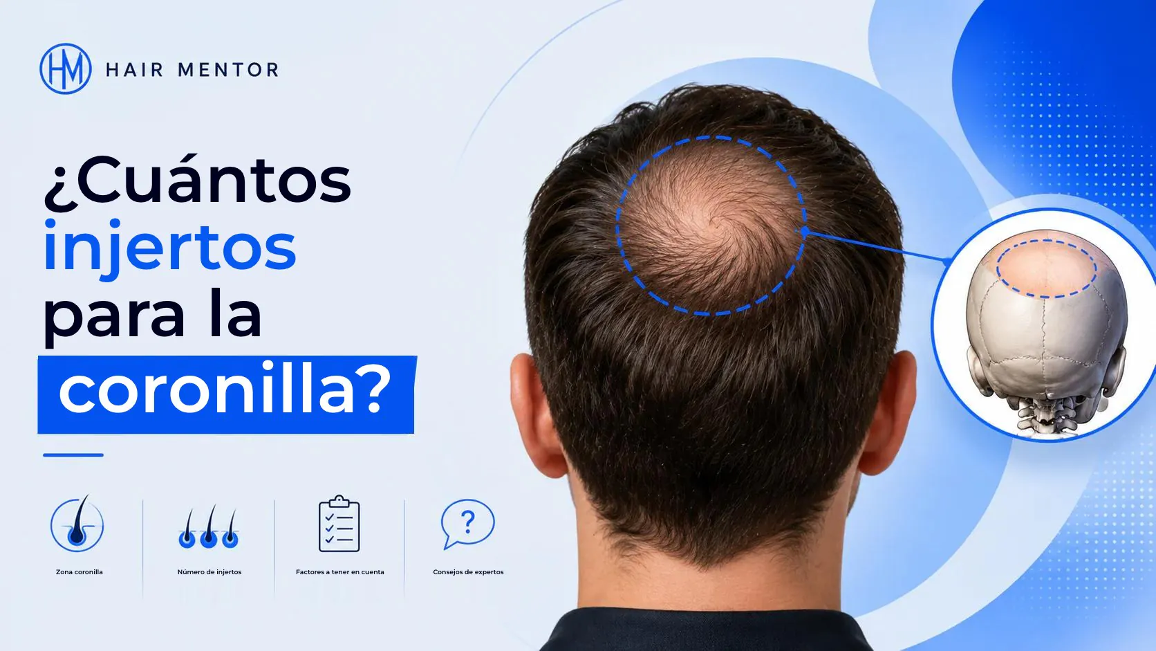Cuántos injertos hacen falta para la coronilla