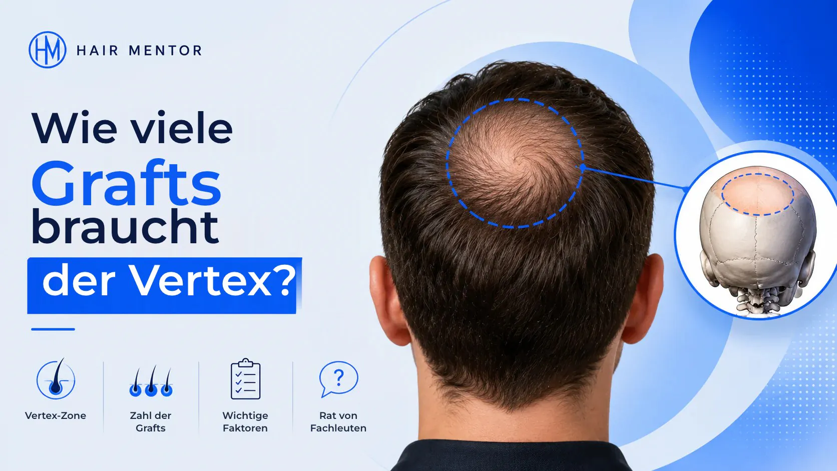 Wie viele Grafts braucht der Vertex?