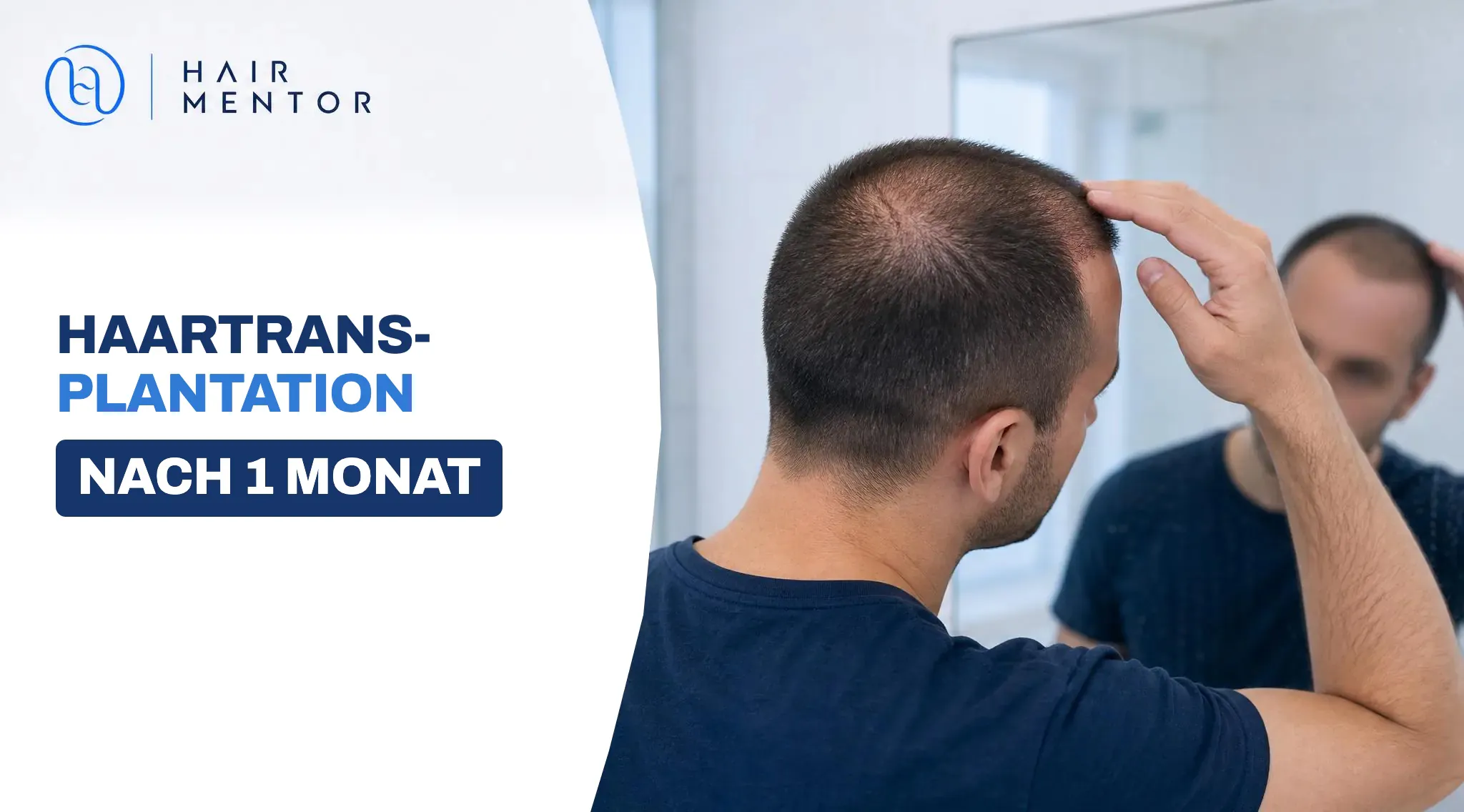 Mann betrachtet sein Haar im Spiegel einen Monat nach der Haartransplantation