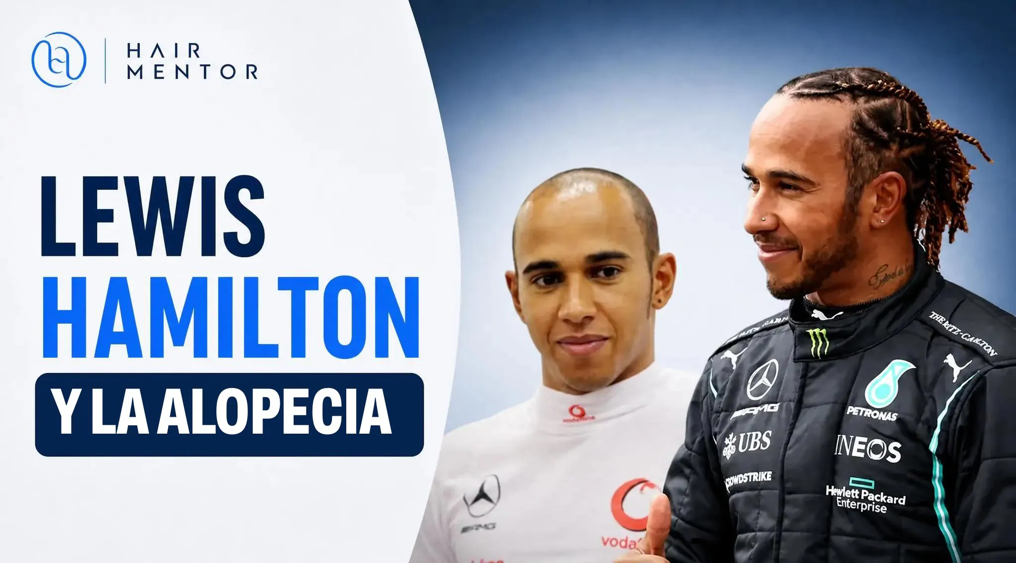 Lewis Hamilton y la alopecia
