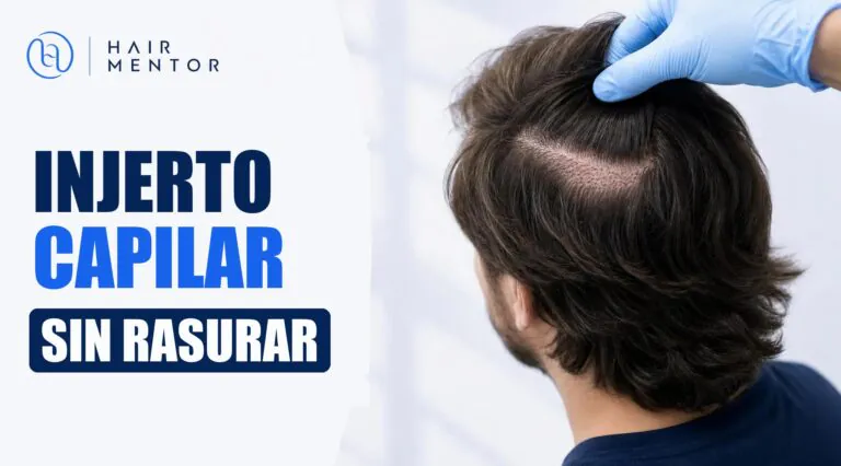 Injerto capilar sin rasurar: pelo largo conservado justo después de la operación