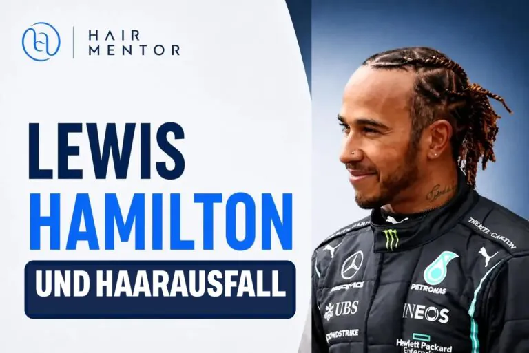 Lewis Hamilton und Haarausfall