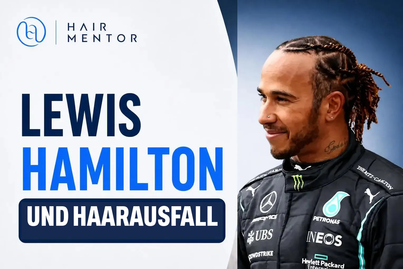Lewis Hamilton und Haarausfall