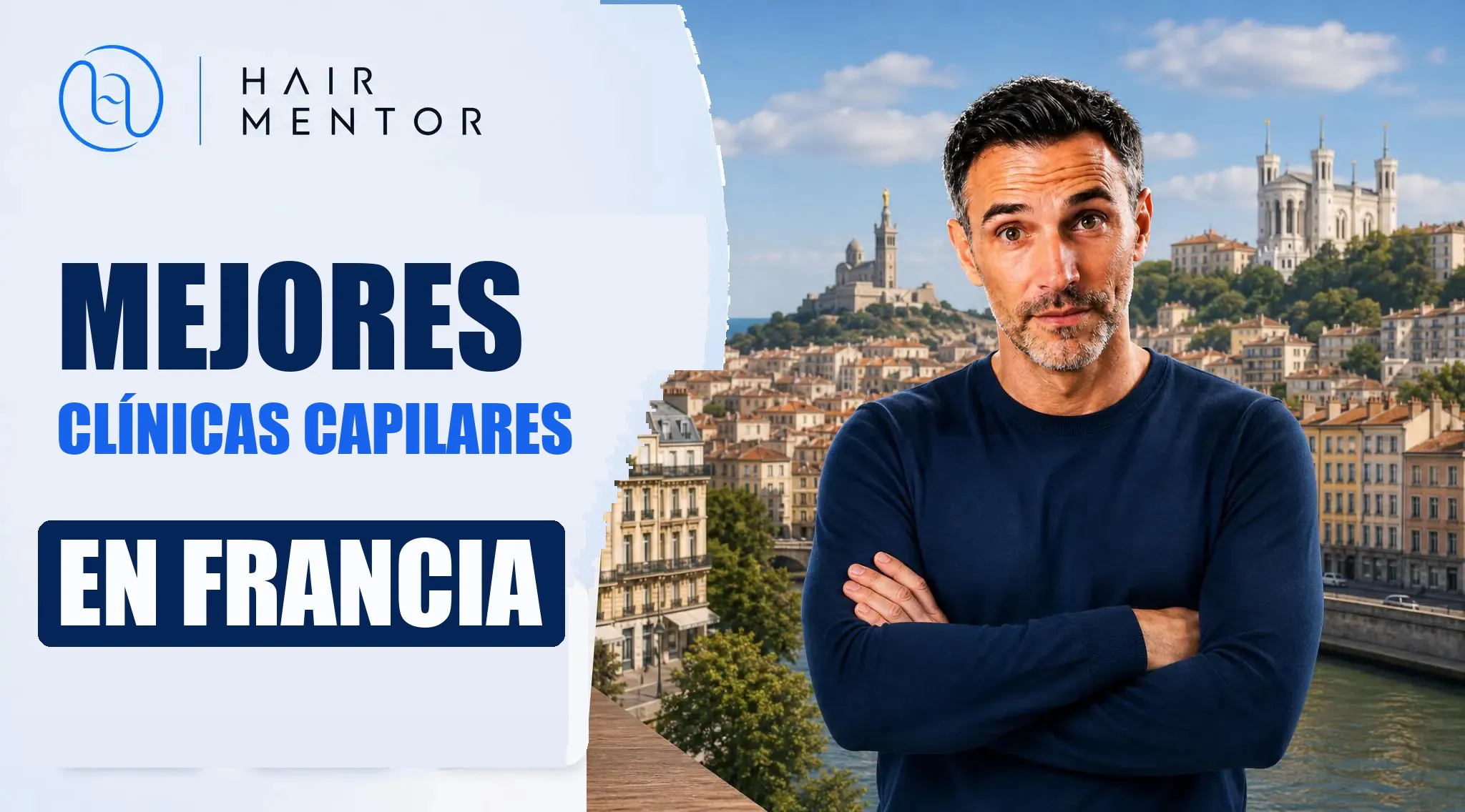 Las mejores clínicas capilares de Francia: nuestro top 7 y los precios