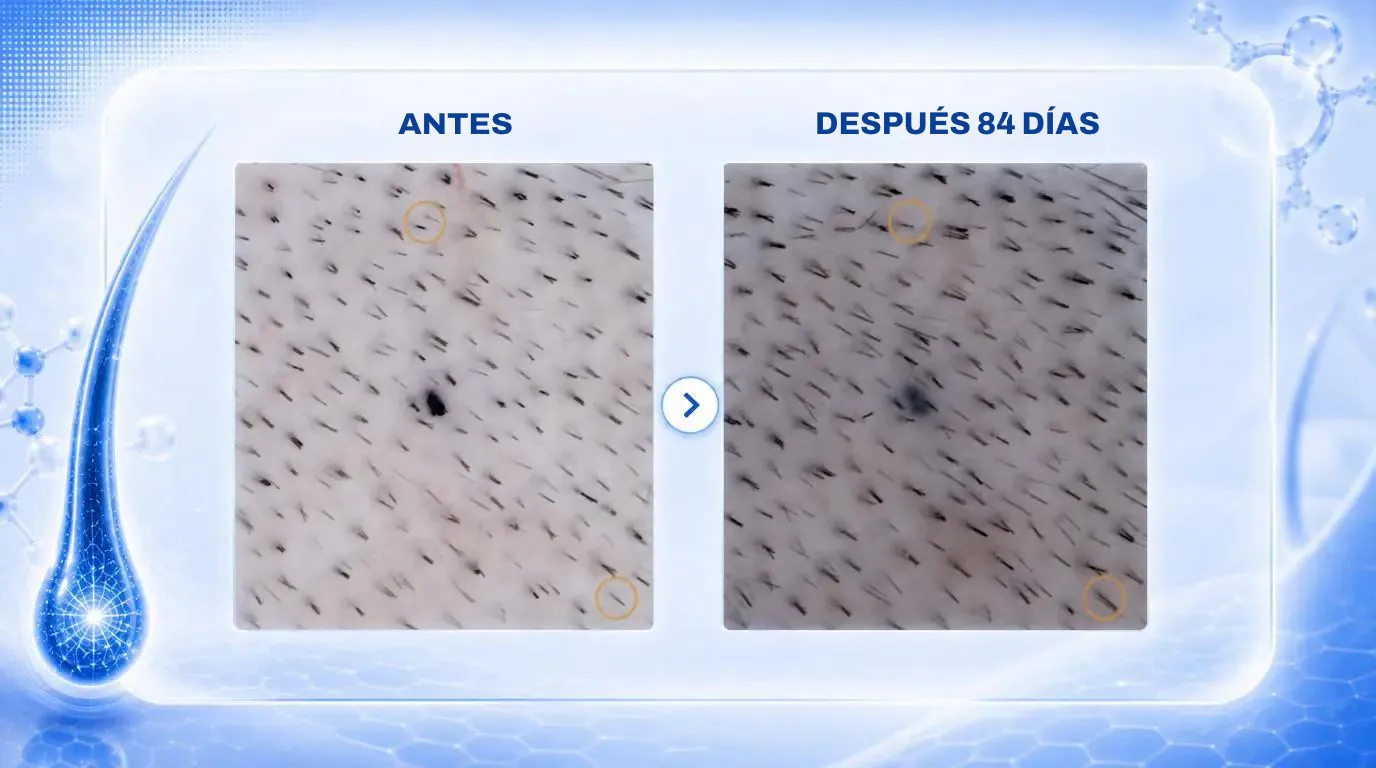 Folículos ya activos que pasan de 1-2 a 3-4 pelos (círculos amarillos/naranjas), según la presentación de Pelage en la AAD 2026.