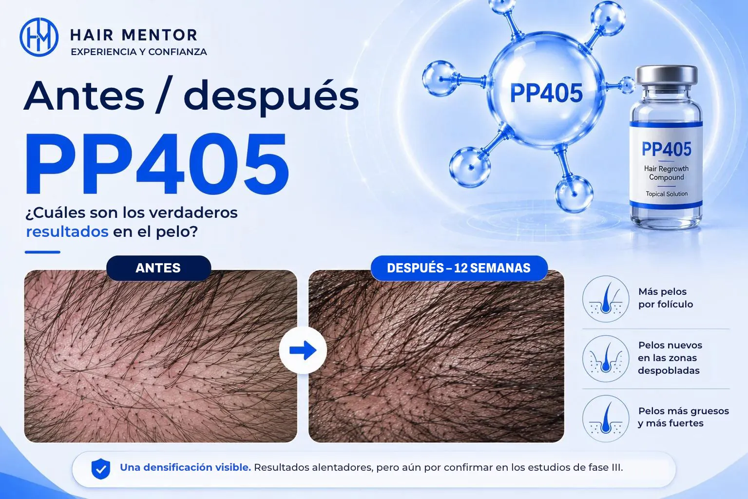 Antes / después de PP405