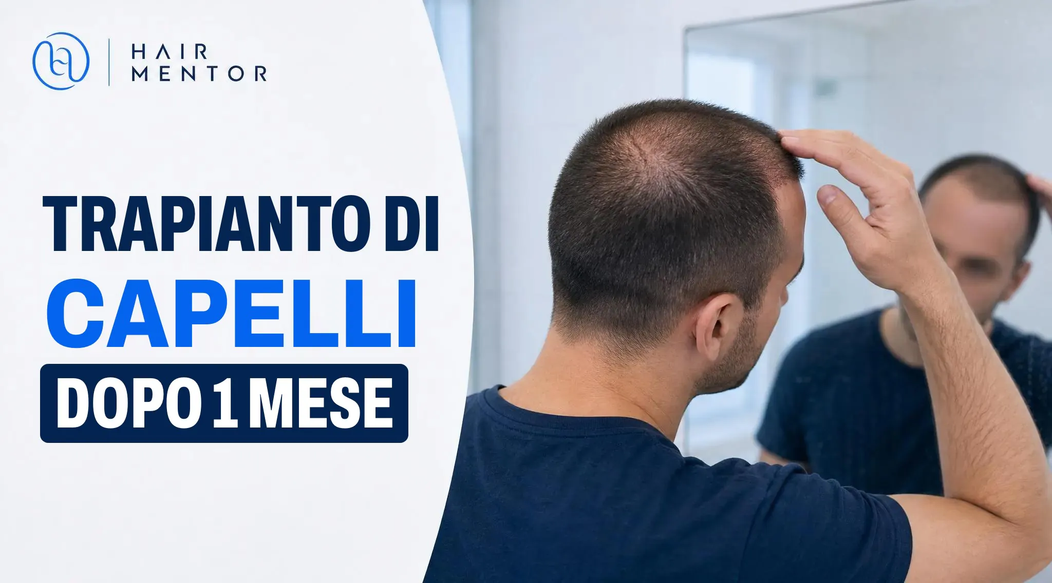 Uomo che si osserva la nuca allo specchio un mese dopo il trapianto