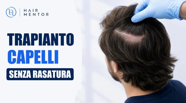 Trapianto di capelli senza rasatura: capelli lunghi conservati dopo l intervento